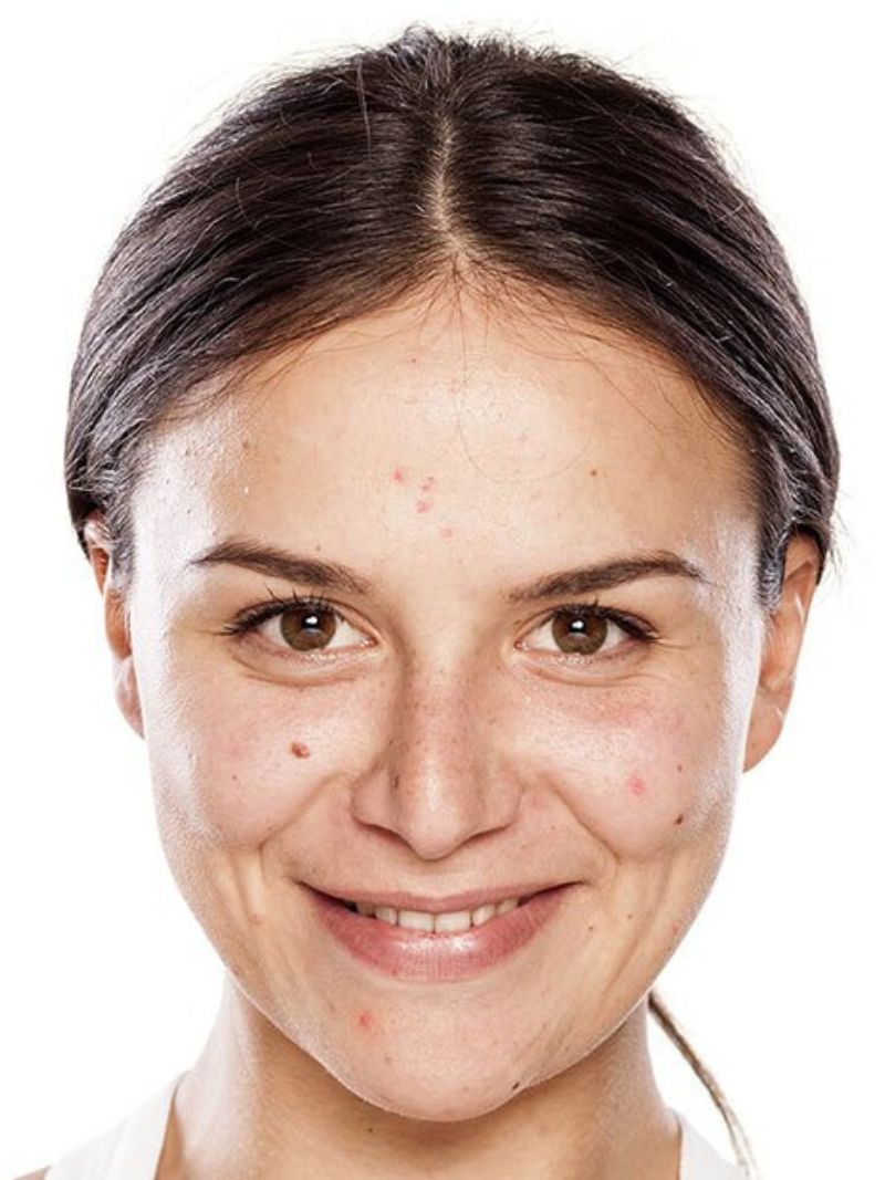 Skin smoothening before image, Skin retouching software, portrait photo editing software