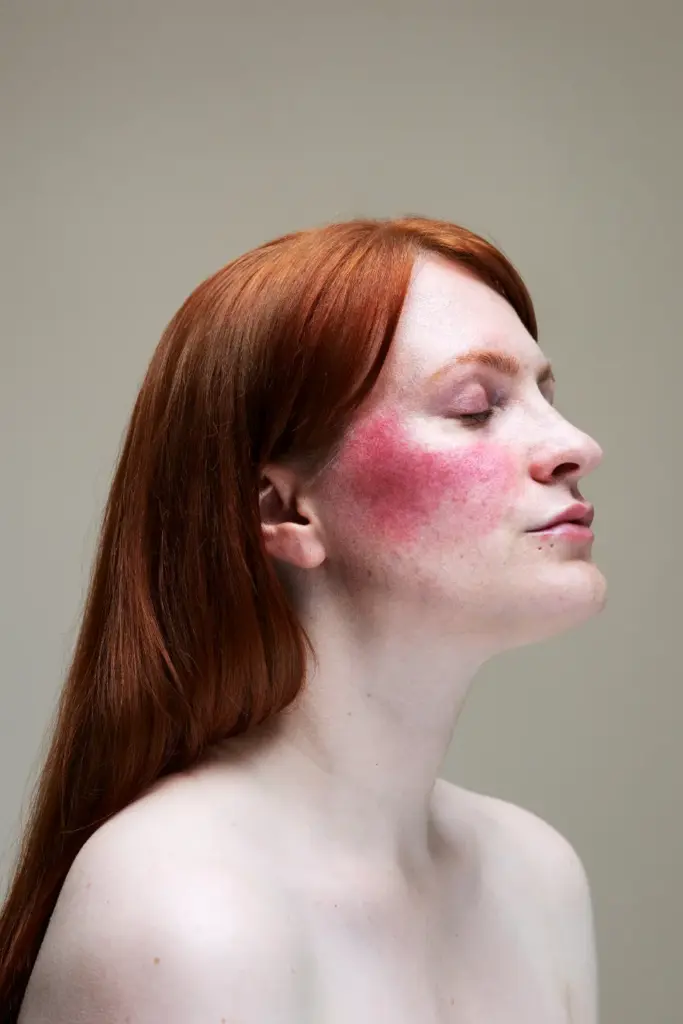 Epidermis : Sophie Harris Taylor
