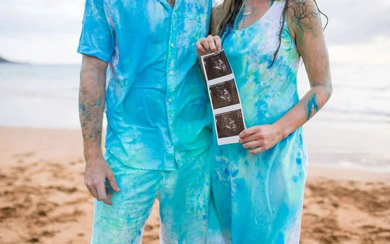 sonogram gender reveal